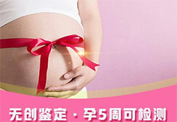 玉溪胎儿需要怎么办理亲子鉴定，玉溪无创孕期亲子鉴定价格